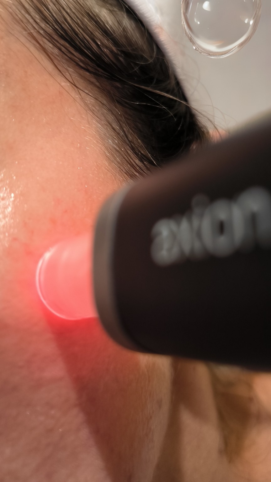 Soin AXION Mesoestetic Soin AXION Mesoestetic avec lumière LED rouge chez Lady Beauty à Nice